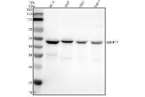 anti-Synaptosomal-Associated Protein, 47kDa (SNAP47) (AA 1-440) antibody