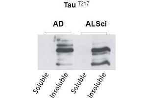 Western blot detection of insoluble phospho-Tau protein using the anti-Tau (Thr-217) antibody in samples isolated from patients with a neurodegenerative disease (Amyotropic lateral sclerosis, ALS or Alzheimer’s disease, AD (tau Antikörper  (pThr217))