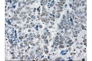 Immunohistochemical staining of paraffin-embedded colon tissue using anti-PRKYmouse monoclonal antibody. (PRKY Antikörper)
