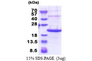 SDS-PAGE (SDS) image for Triggering Receptor Expressed On Myeloid Cells 2 (TREM2) (AA 19-161) protein (His tag) (ABIN5853402) (TREM2 Protein (AA 19-161) (His tag))