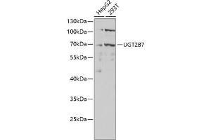 Western blot analysis of extracts of various cell lines, using UGT2B7 antibody (ABIN6132908, ABIN6149903, ABIN6149904 and ABIN6218790) at 1:1000 dilution. (UGT2B7 Antikörper  (AA 25-351))