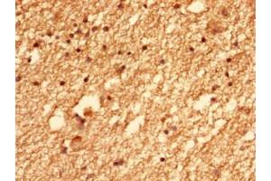 Immunohistochemistry of paraffin-embedded human brain tissue using ABIN7147383 at dilution of 1:100 (CEP126 Antikörper  (AA 559-670))