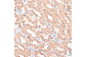 Immunohistochemistry of paraffin-embedded human stomach using HMG antibody (635) at dilution of 1:100 (40x lens). (HMGA1 Antikörper  (AA 1-100))