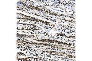IHC analysis of PTBP1 using anti-PTBP1 antibody (ABIN7599450). (PTBP1 Antikörper  (AA 1-504))