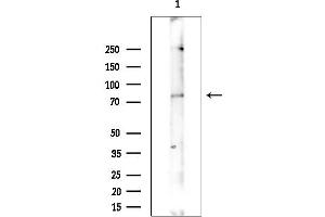 Western blot analysis of lysates from COLO205 cells(heat-shock treatment), using Phospho-PKC beta 1 (Ser661) Antibody at 1/1000 dilution.