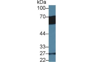 Detection of GP6 in Human Serum using Polyclonal Antibody to Glycoprotein VI (GP6) (GP6 Antikörper  (AA 86-231))