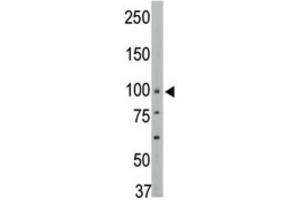 Western Blotting (WB) image for anti-Protein tyrosine Phosphatase, Non-Receptor Type 3 (PTPN3) antibody (ABIN3003754) (PTPN3 Antikörper)