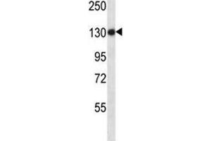 Anti-TLR8 antibody western blot analysis in NCI-H460 lysate