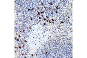Immunohistochemistry (IHC) image for anti-Cathepsin G (CTSG) (AA 21-255) antibody (ABIN6139229)