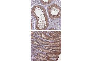 Immunohistochemical staining of human stomach with CORO2A polyclonal antibody  shows cytoplasmic and moderate membranous positivity in glandular cells. (CORO2A Antikörper)