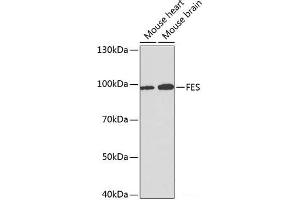 Western blot analysis of extracts of various cell lines using FES Polyclonal Antibody at dilution of 1:1000. (FES Antikörper)