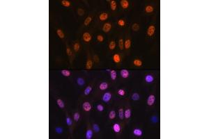 Immunofluorescence analysis of NIH-3T3 cells using B Rabbit mAb (ABIN7265377) at dilution of 1:100 (40x lens). (ANP32B Antikörper)