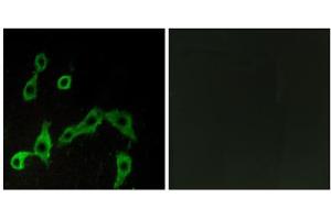 Immunofluorescence analysis of LOVO cells, using ADRA2A antibody. (ADRA2A Antikörper  (Internal Region))