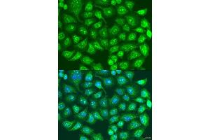 Immunofluorescence analysis of U2OS cells using SPICE1 antibody. (SPICE1 Antikörper  (AA 1-220))