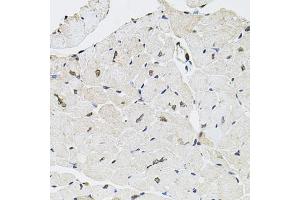Immunohistochemistry of paraffin-embedded mouse heart using GTF2H2 antibody (ABIN1876505) at dilution of 1:100 (40x lens).