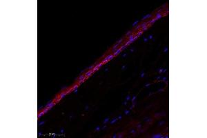Immunofluorescence (Paraffin-embedded Sections) (IF (p)) image for anti-Centrosomal Protein 78kDa (CEP78) antibody (ABIN7073432)
