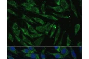 Immunofluorescence analysis of L929 cells using PITRM1 Polyclonal Antibody at dilution of 1:100 (40x lens). (PITRM1 Antikörper)