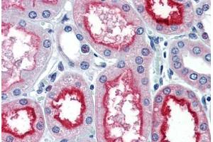 Human Kidney (formalin-fixed, paraffin-embedded) stained with ACE antibody ABIN337280 at 10 ug/ml followed by biotinylated anti-mouse IgG secondary antibody ABIN481714, alkaline phosphatase-streptavidin and chromogen. (Angiotensin I Converting Enzyme 1 Antikörper)