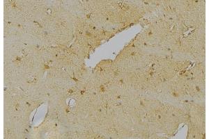 ABIN6263605 and ABIN6276415 at 1/100 staining Mouse brain tissue by IHC-P.
