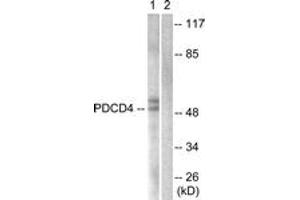 Western blot analysis of extracts from 293 cells, using PDCD4 (Ab-457) Antibody. (PDCD4 Antikörper  (AA 420-469))