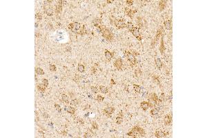 Immunohistochemistry (IHC) image for anti-alpha Ketoglutarate Dehydrogenase (alphaKGDHC) (AA 148-427) antibody (ABIN6145003)