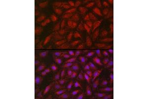 Immunofluorescence analysis of U2OS cells using SOCS3 Rabbit pAb (ABIN3015316, ABIN3015317, ABIN5663764 and ABIN6213984) at dilution of 1:50 (40x lens). (SOCS3 Antikörper  (C-Term))