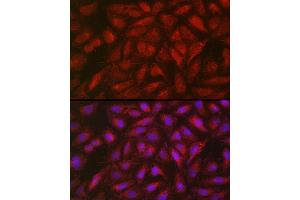 Immunofluorescence analysis of U2OS cells using SOCS3 Rabbit pAb (ABIN3015316, ABIN3015317, ABIN5663764 and ABIN6213984) at dilution of 1:50 (40x lens). (SOCS3 Antikörper  (C-Term))