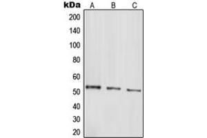 Western blot analysis of Parkin expression in HepG2 (A), SHSY5Y (B), SW480 (C) whole cell lysates.