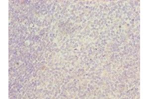 Immunohistochemistry of paraffin-embedded human tonsil tissue using ABIN7156460 at dilution of 1:100 (ITGAL Antikörper  (AA 201-500))
