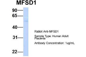 Host:  Rabbit  Target Name:  MFSD1  Sample Type:  Human Adult Placenta  Antibody Dilution:  1. (MFSD1 Antikörper  (Middle Region))