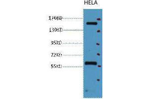 Western Blot (WB) analysis of HeLa, diluted at 1:2000. (CD45 Antikörper)