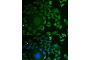 Immunofluorescence analysis of U2OS cells using C1D Polyclonal Antibody (C1D Antikörper)