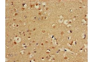 Immunohistochemistry of paraffin-embedded human brain tissue using ABIN7146829 at dilution of 1:100 (CPT1C Antikörper  (AA 699-803))
