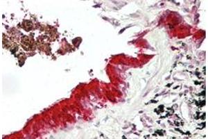 Immunohistochemical staining (Formalin-fixed paraffin-embedded sections) of human lung with MXI1 polyclonal antibody  at 4-8 ug/mL working concentration.