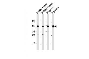 All lanes : Anti-IGHG1 Antibody (Center) at 1:2000 dilution Lane 1: human fetal spleen lysate Lane 2: human fetal thymus lysate Lane 3: human spleen lysate Lane 4: human plasma lysate Lysates/proteins at 20 μg per lane. (IGHG1 Antikörper  (AA 74-102))