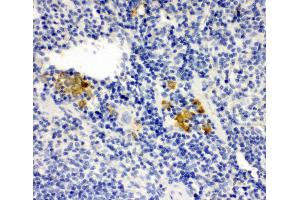 Anti-Leupaxin antibody, IHC(P) IHC(P): Mouse Spleen Tissue (Leupaxin Antikörper  (N-Term))