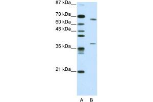 WB Suggested Antibody Titration:  0. (GRHL3 Antikörper  (C-Term))