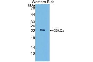 Detection of Recombinant PGLYRP1, Mouse using Polyclonal Antibody to Peptidoglycan Recognition Protein 1 (PGLYRP1) (PGLYRP1 Antikörper  (AA 19-182))