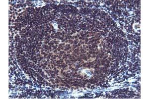 Image no. 1 for anti-Cystatin SA (CST2) antibody (ABIN1497759) (CST2 Antikörper)