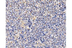 IHC analysis of PMPCA/INPP5 using anti-PMPCA/INPP5 antibody (ABIN7602722). (PMPCA Antikörper  (AA 99-525))