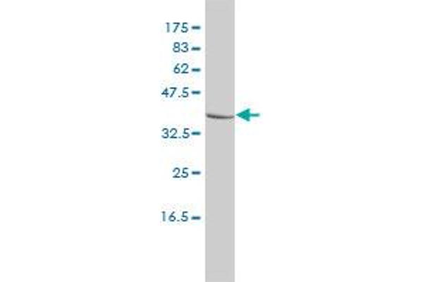 CTBS Antikörper  (AA 37-105)