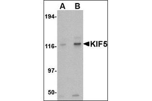 Western blot analysis of KIF5 in K562 cell lysate with this product at (A) 0. (KIF5A Antikörper  (Center))