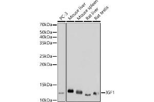 Western blot analysis of extracts of various cell lines, using IGF1 antibody (ABIN1682184, ABIN3015345, ABIN3015346 and ABIN7101347) at 1:1000 dilution. (IGF1 Antikörper)