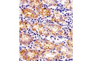 (ABIN6242877 and ABIN6578324) staining SLC22A2 in human stomach tissue sections by Immunohistochemistry (IHC-P - paraformaldehyde-fixed, paraffin-embedded sections). (SLC22A2 Antikörper  (N-Term))