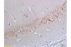 Formalin-fixed and paraffin embedded rat brain labeled with Anti-ApoER2 Polyclonal Antibody, Unconjugated (ABIN719426) at 1:200 followed by conjugation to the secondary antibody and DAB staining (LRP8 Antikörper  (AA 851-963))