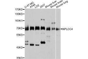 Western blot analysis of extracts of various cell lines, using NPLOC4 antibody (ABIN4904565) at 1:3000 dilution. (NPLOC4 Antikörper)