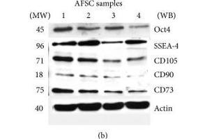 Effect of donor heterogeneity on stem cells markers. (CD73 Antikörper)
