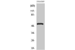 Western Blotting (WB) image for anti-ATPase, H+ Transporting, Lysosomal 50/57kDa, V1 Subunit H (ATP6V1H) (Internal Region) antibody (ABIN3187455) (ATP6V1H Antikörper  (Internal Region))