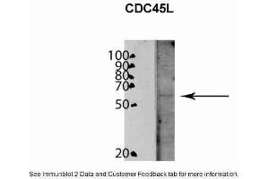 WB Suggested Anti-CDC45L Antibody Titration: 0. (CDC45 Antikörper  (C-Term))