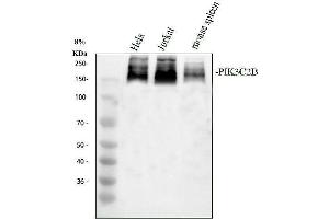 Western blot analysis of PIK3C2B using anti-PIK3C2B antibody (ABIN7825681).